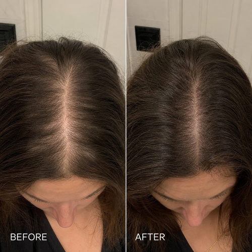 Melomea | Korean Scalp Bar